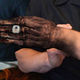 Illustration for article titled Patriots Horrified After New Super Bowl Rings Cause Fingers To Shrivel Up, Turn Black